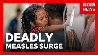 Inside a Bangladesh hospital during a deadly measles outbreak | BBC News