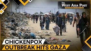 Gaza Faces War and a Rapidly Spreading Chickenpox Outbreak, UN Warns of a Growing Health Emergency