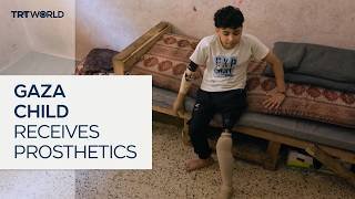 Thousands of Gaza amputees await prosthetic care